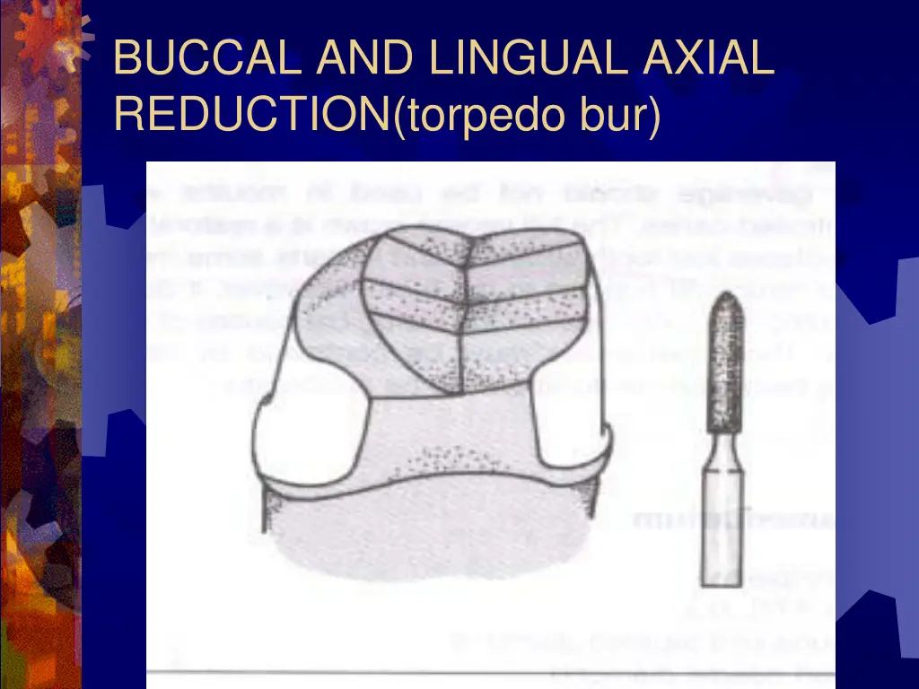 buccal and lingual axial reduction torpedo bur