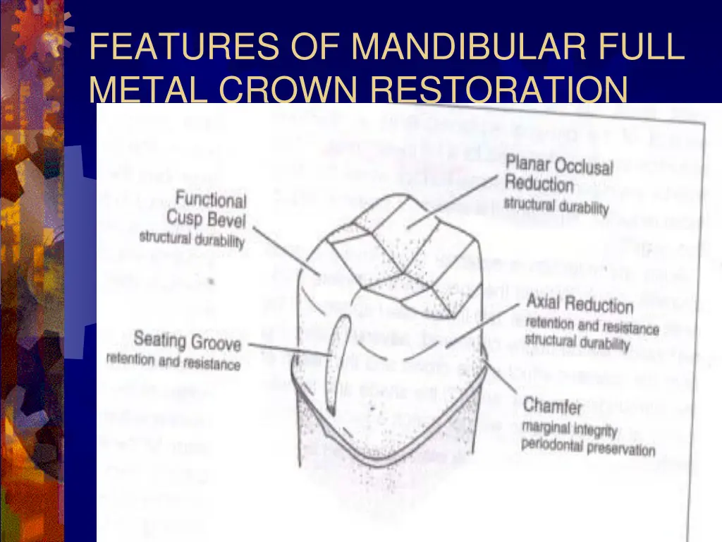 features of mandibular full metal crown