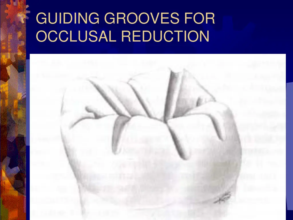 guiding grooves for occlusal reduction