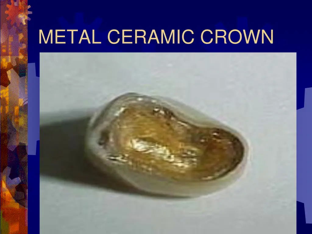 metal ceramic crown