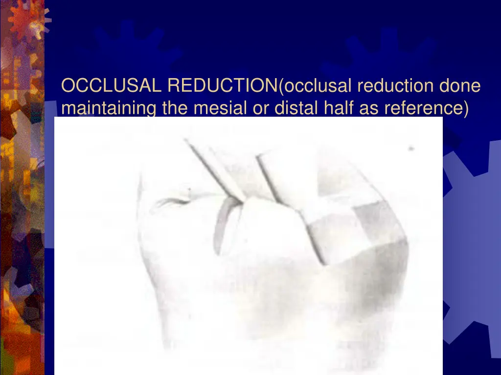 occlusal reduction occlusal reduction done