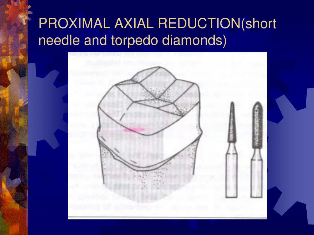 proximal axial reduction short needle and torpedo