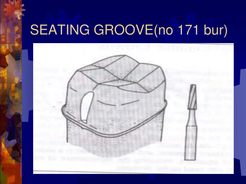 seating groove no 171 bur