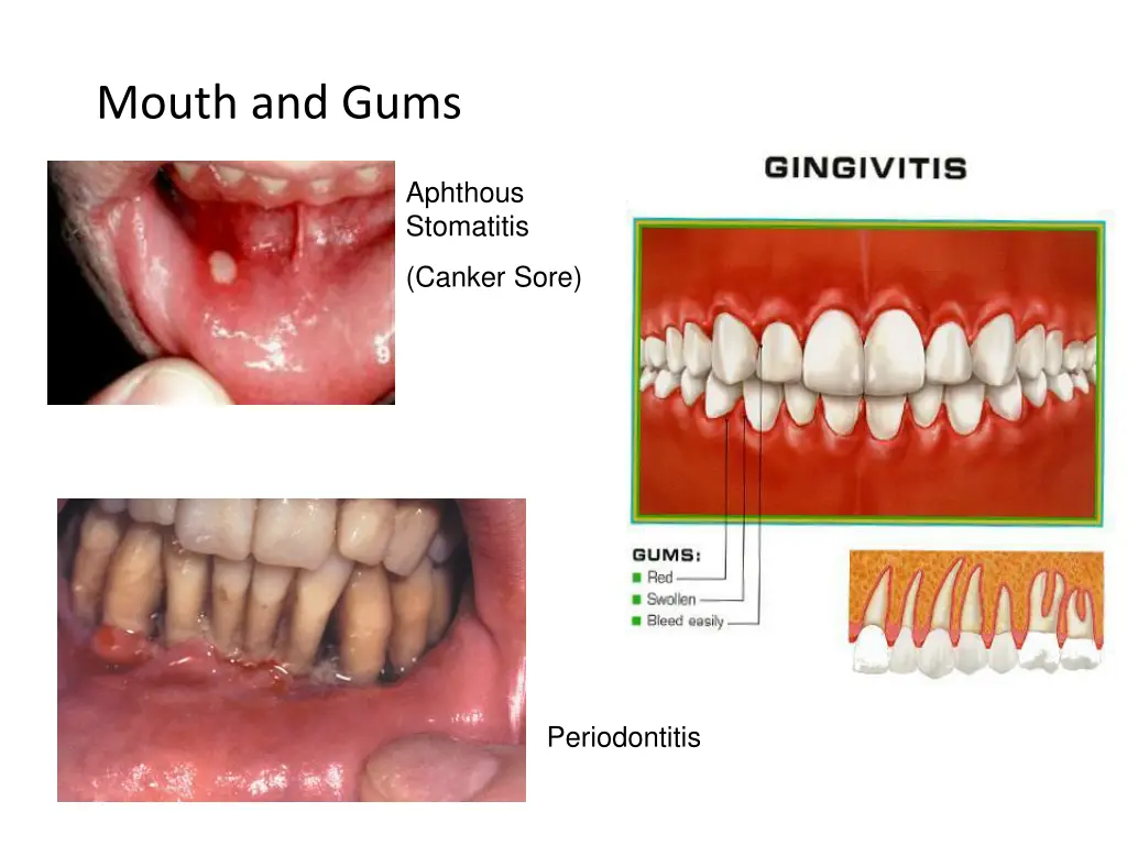 mouth and gums