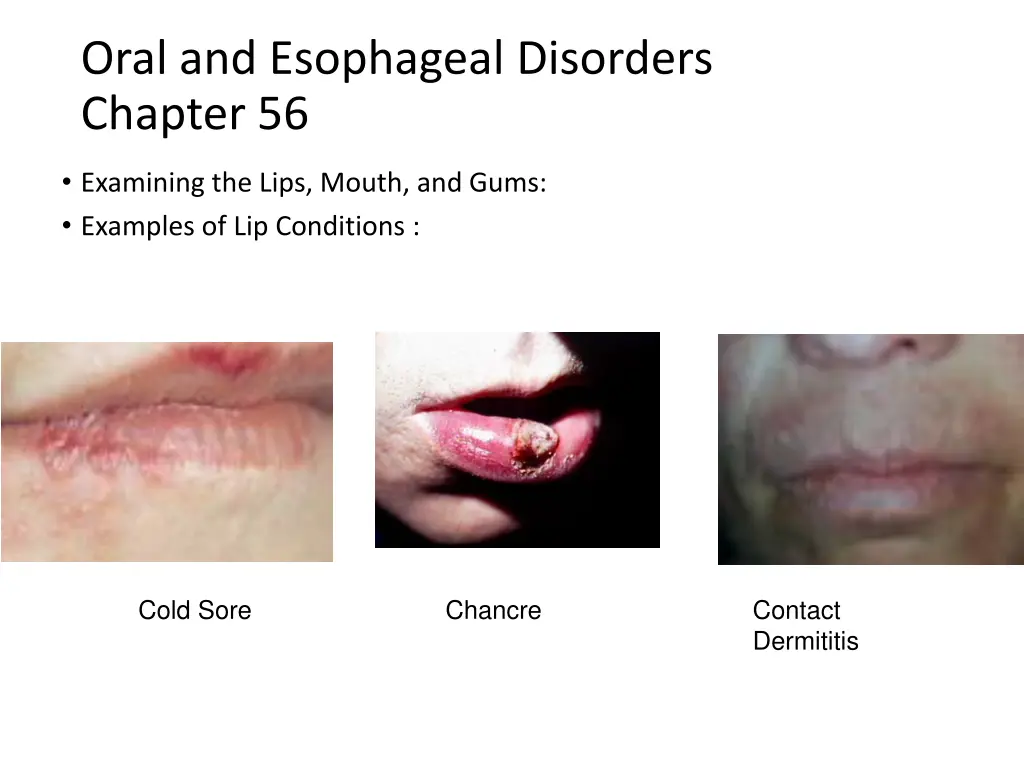 oral and esophageal disorders chapter 56