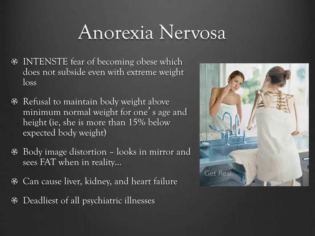 anorexia nervosa