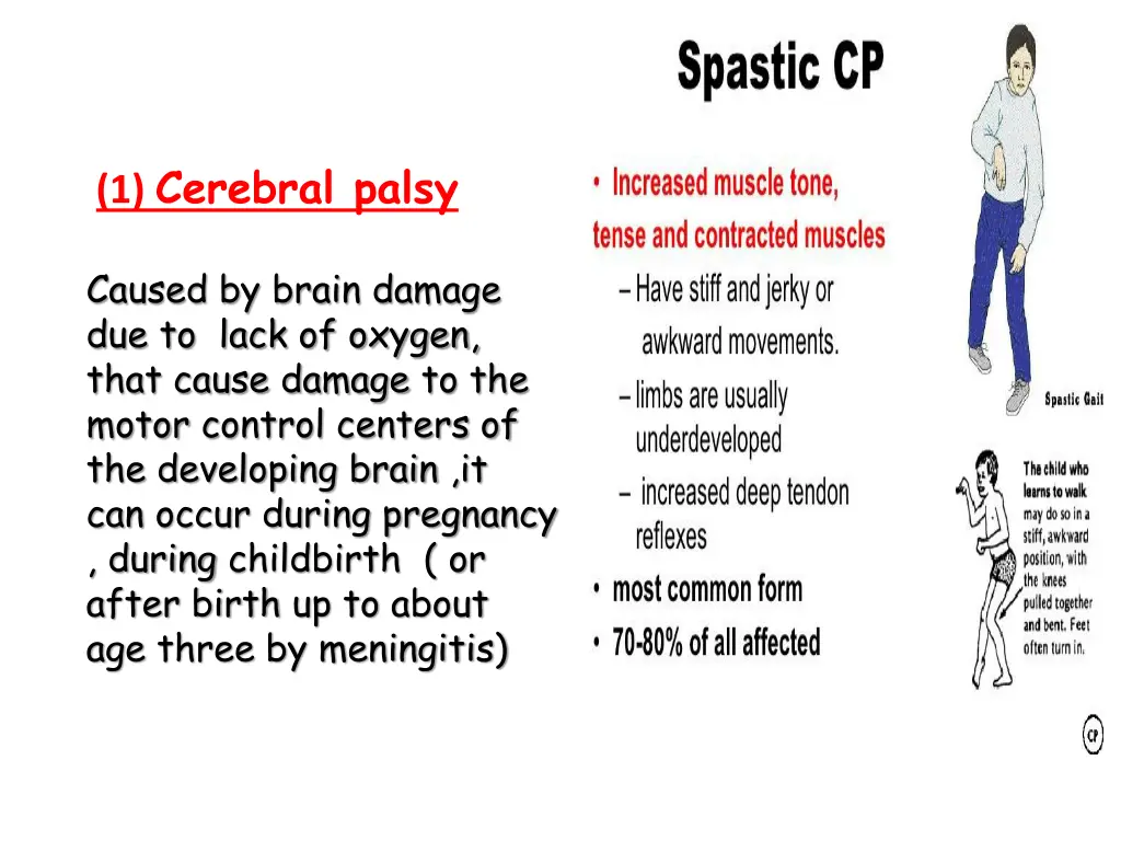 1 cerebral palsy