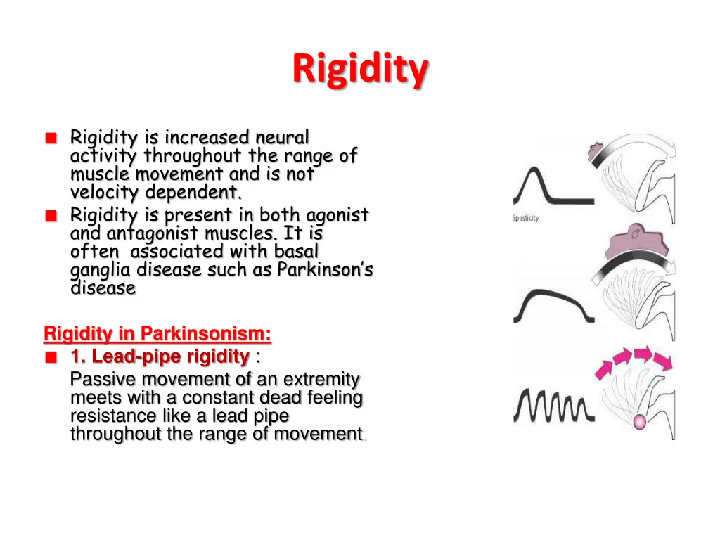 rigidity