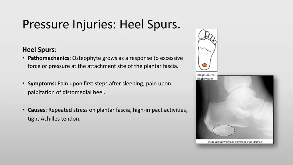 pressure injuries heel spurs