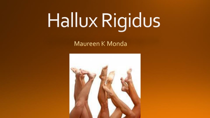 hallux rigidus