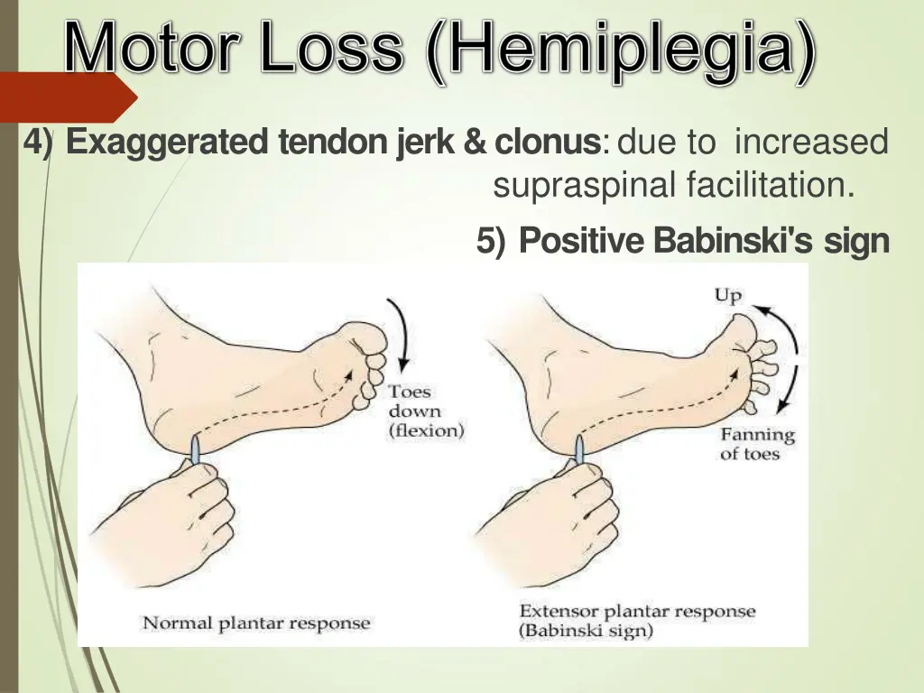 4 exaggerated tendon jerk clonus due to increased