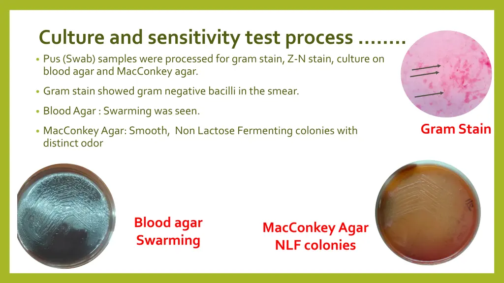 culture and sensitivity test process pus swab