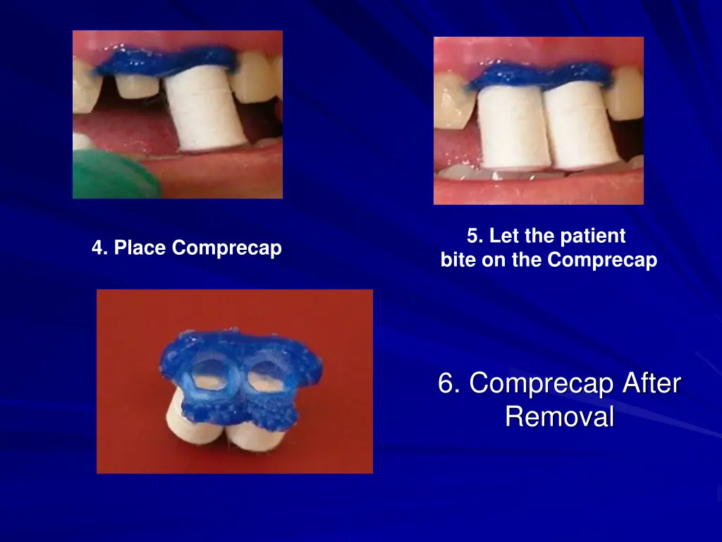 5 let the patient bite on the comprecap