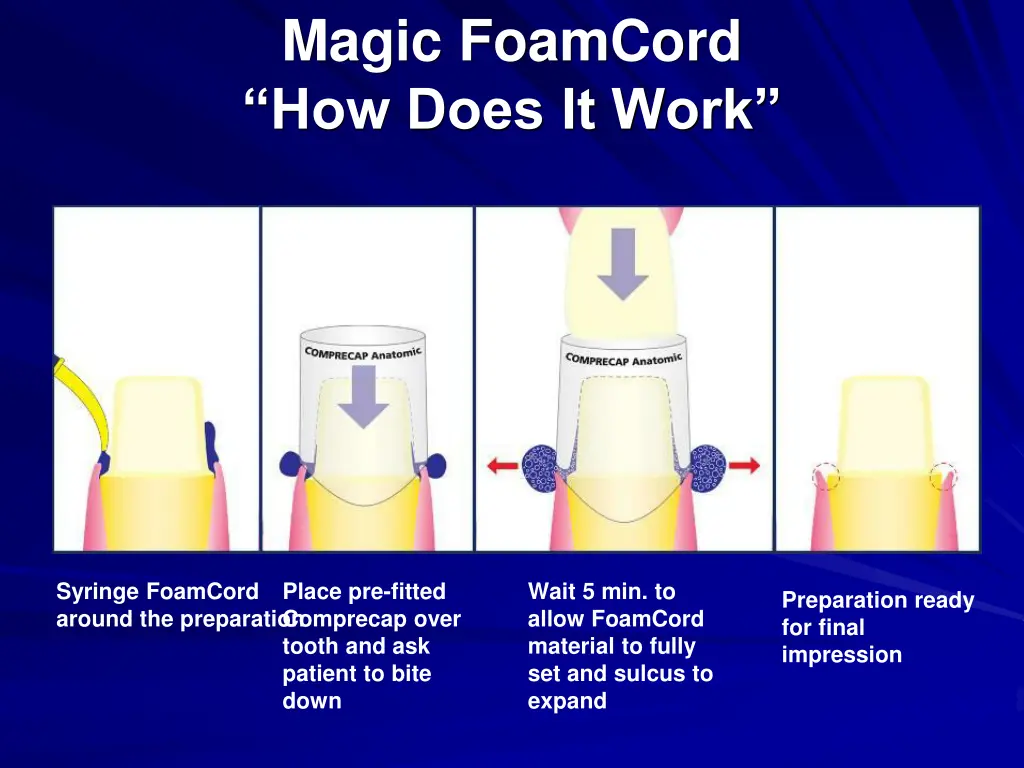 magic foamcord how does it work