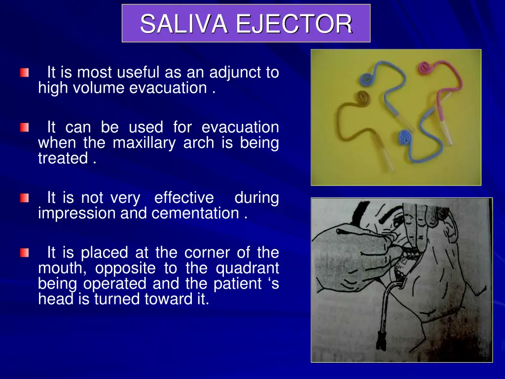 saliva ejector