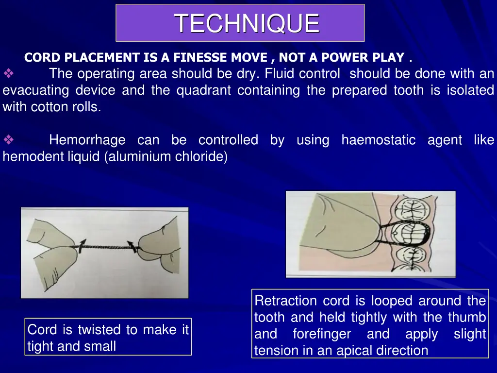 technique 1