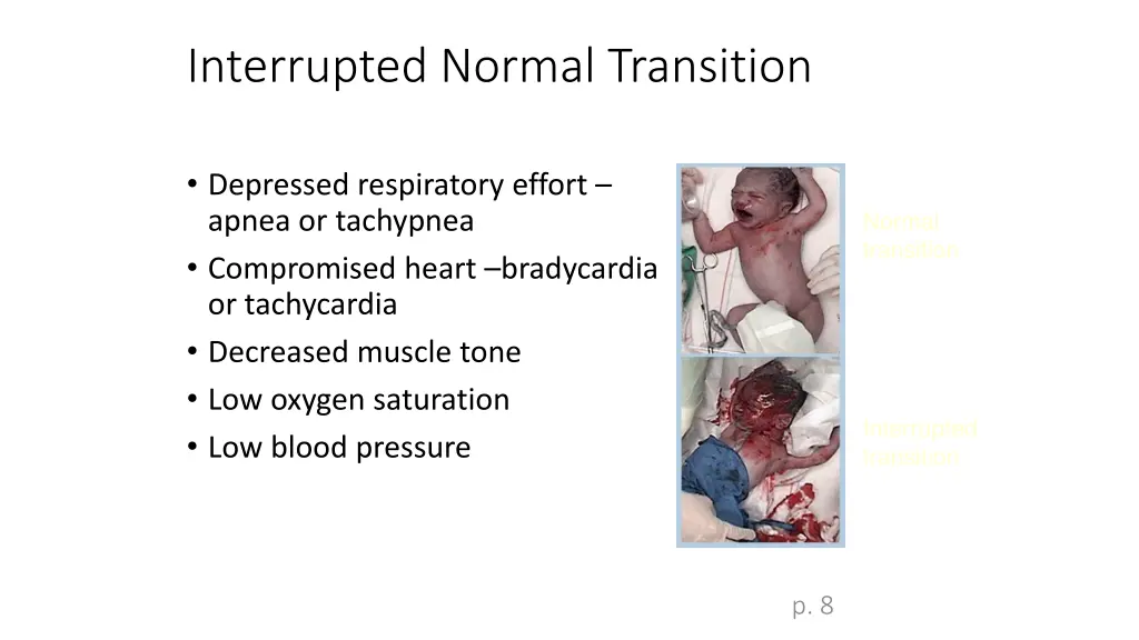 interrupted normal transition