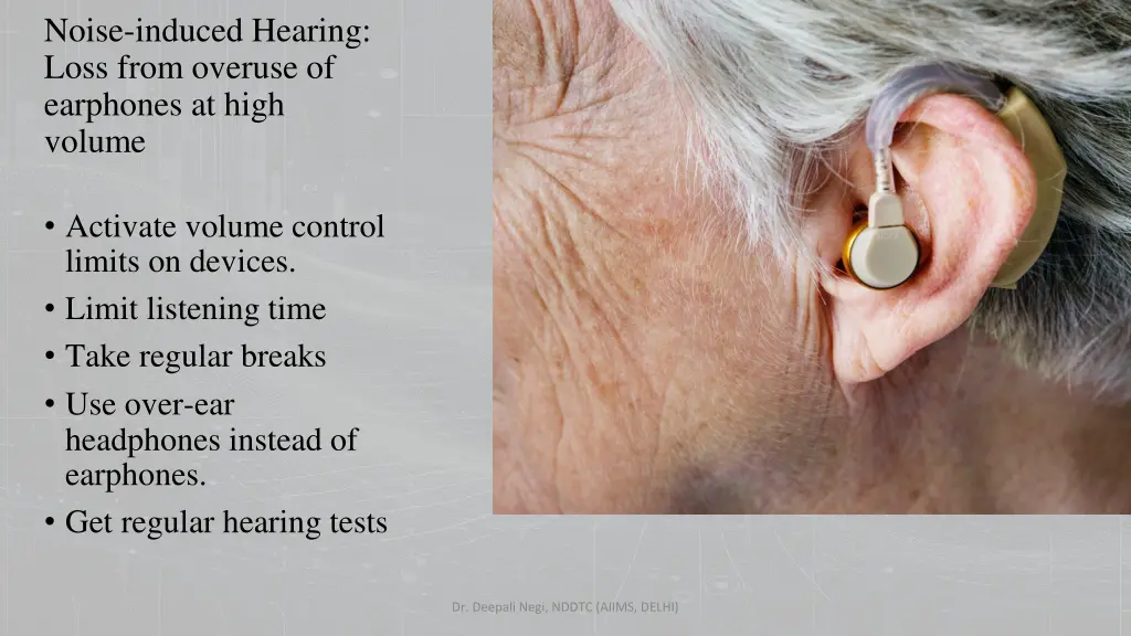 noise induced hearing loss from overuse