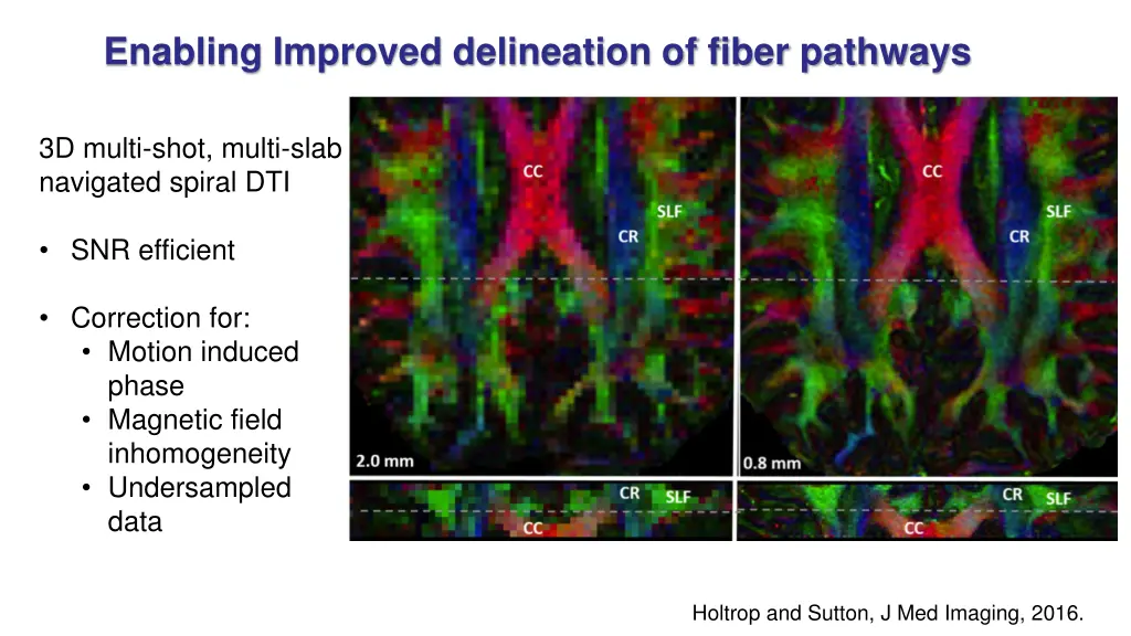 enabling improved delineation of fiber pathways