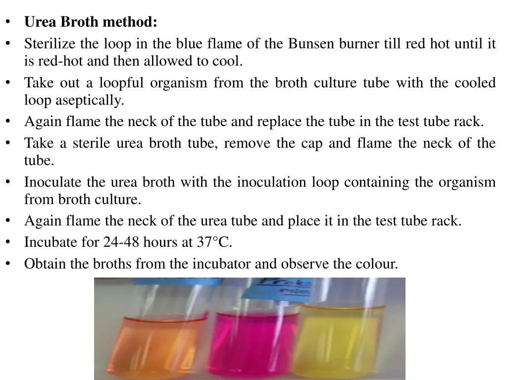 urea broth method sterilize the loop in the blue