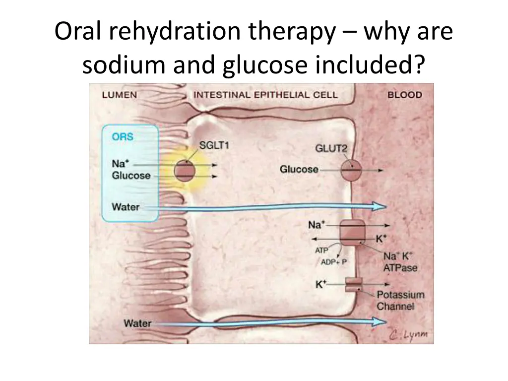 oral rehydration therapy why are sodium