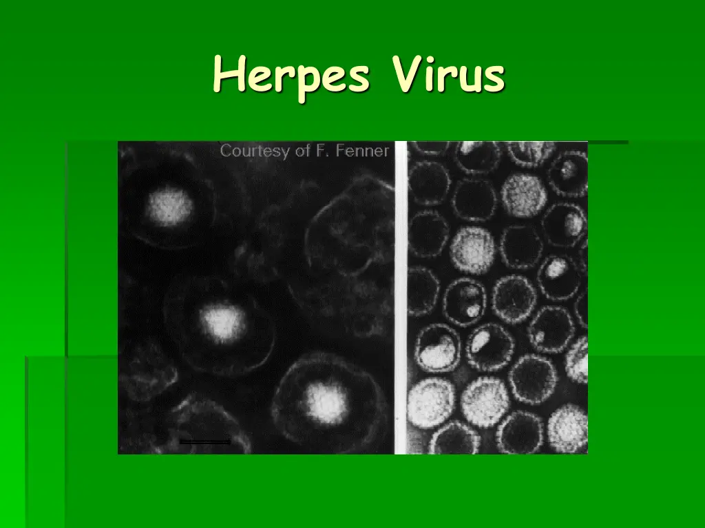 herpes virus