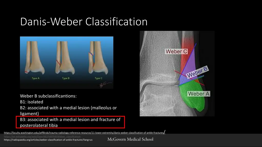 danis weber classification