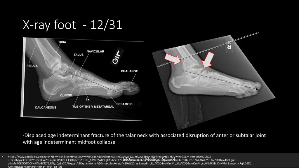 x ray foot 12 31