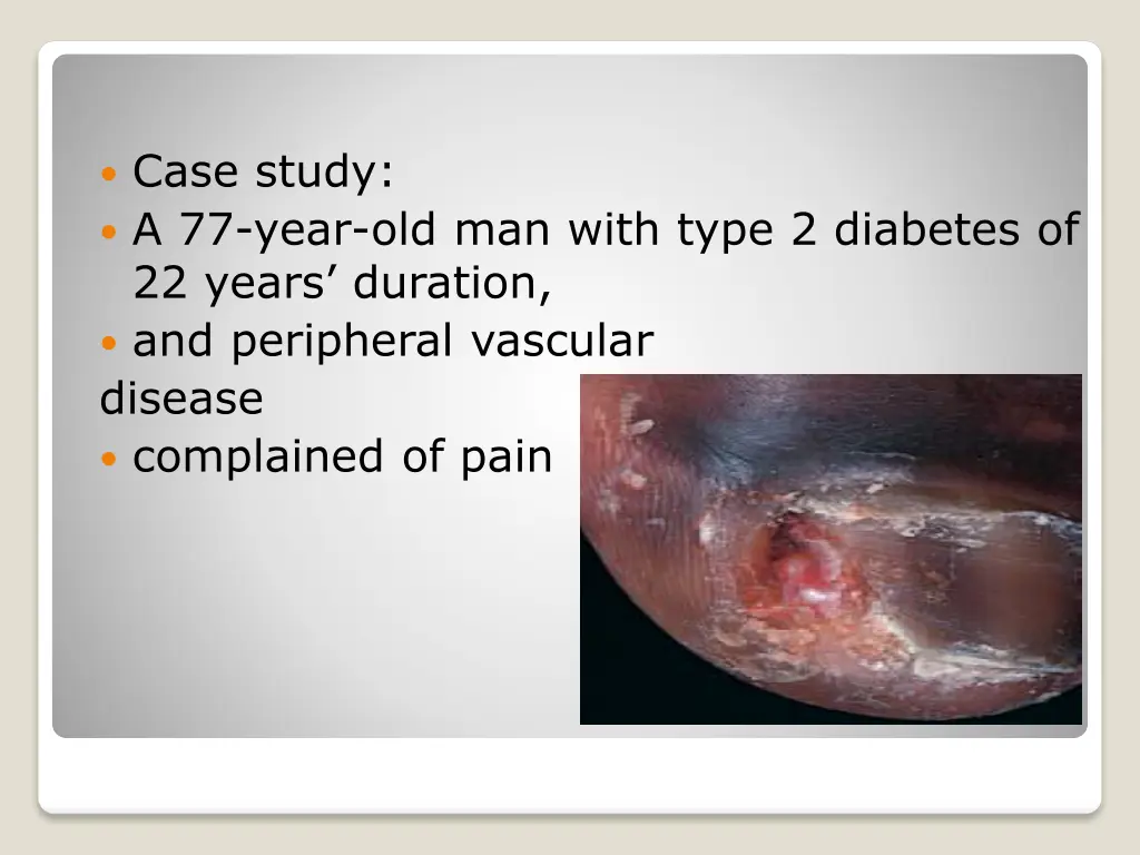 case study a 77 year old man with type 2 diabetes