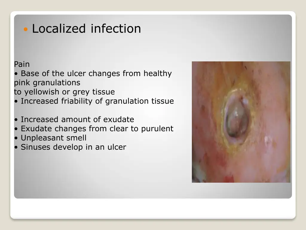 localized infection