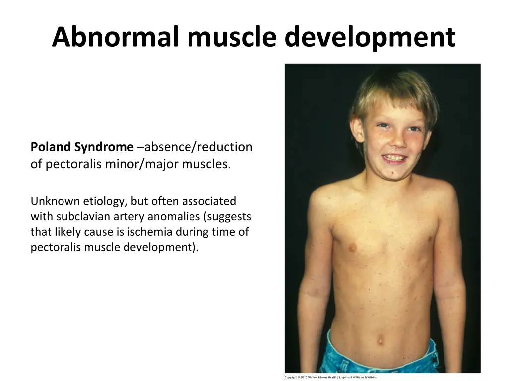 abnormal muscle development