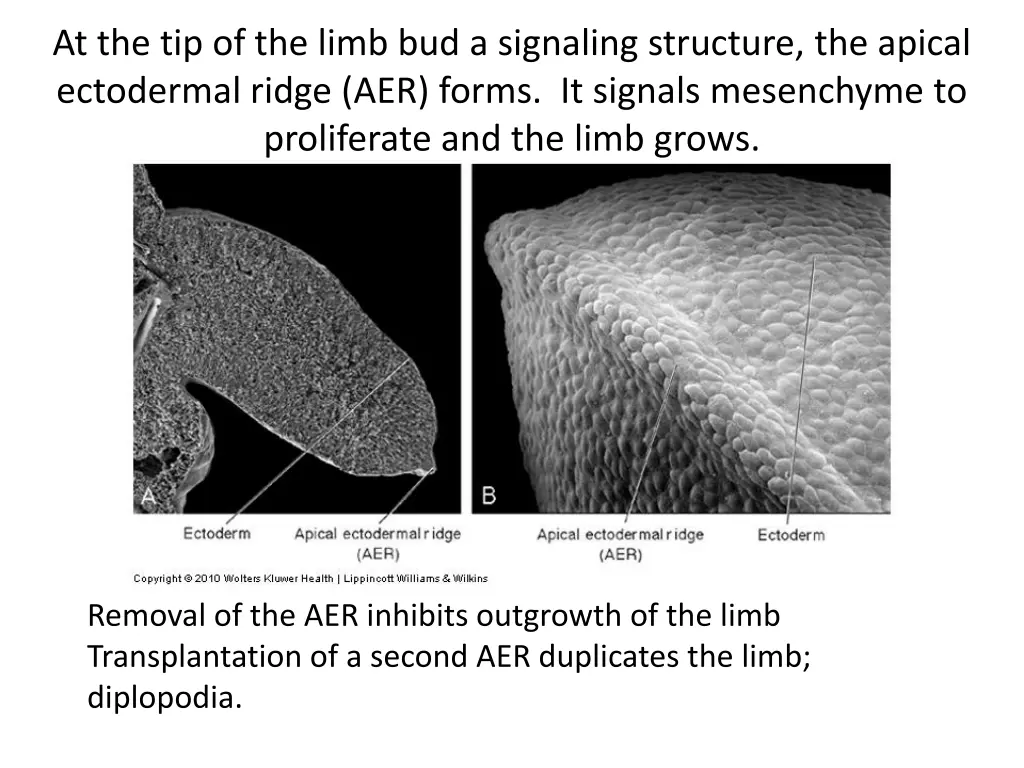 at the tip of the limb bud a signaling structure