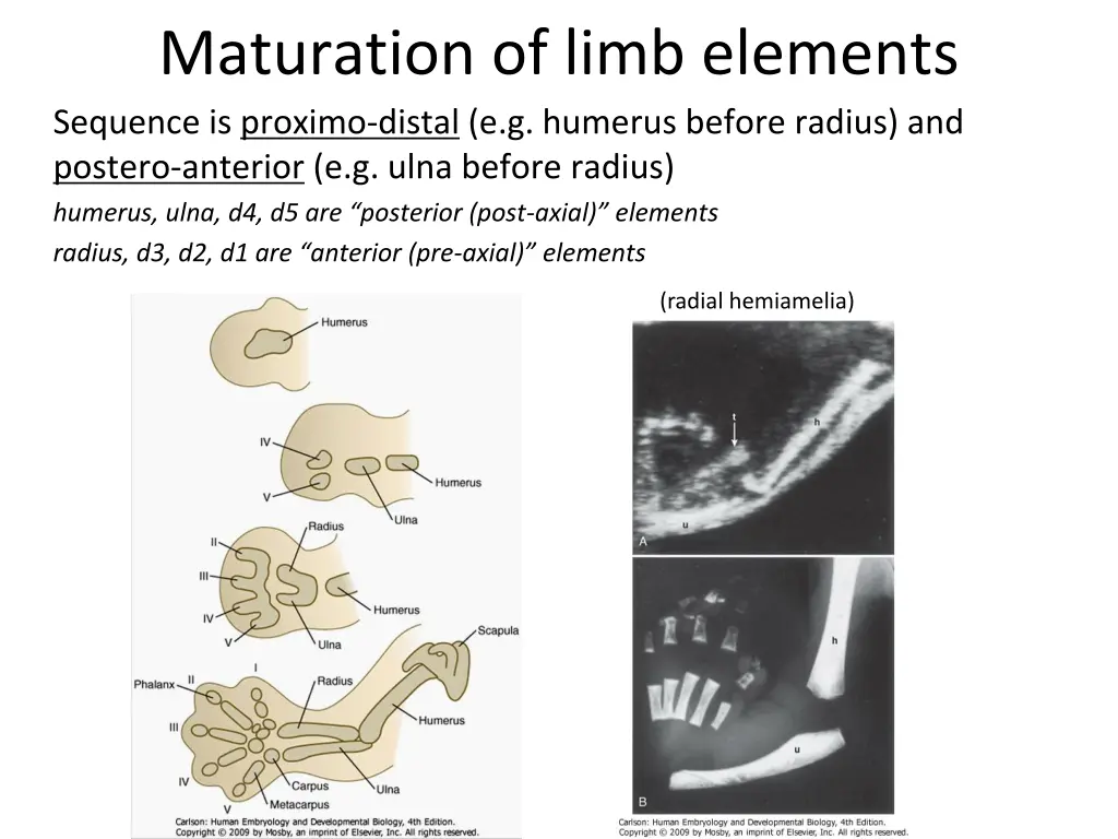 maturation of limb elements sequence is proximo