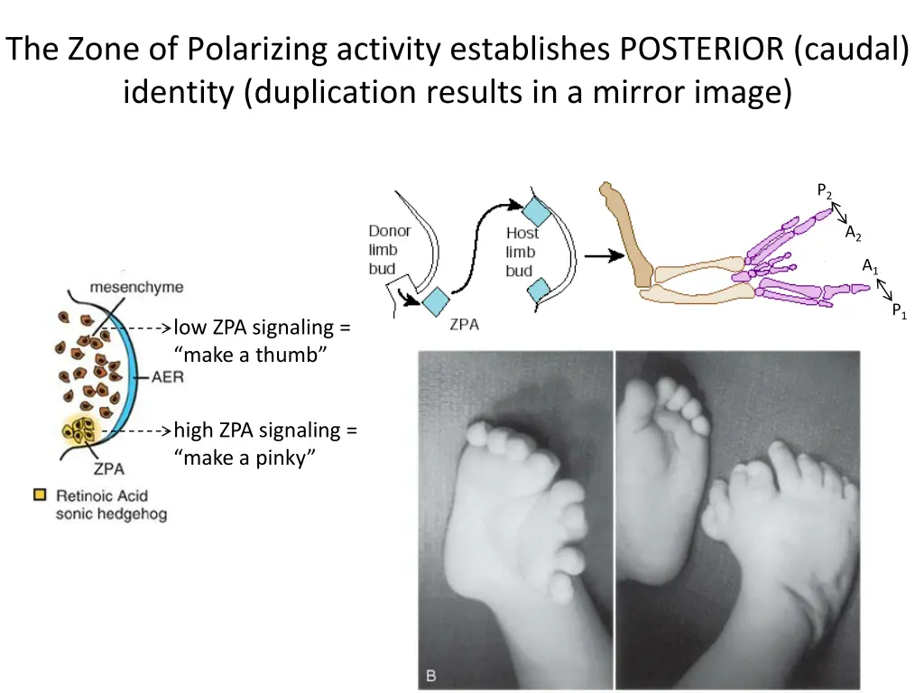 the zone of polarizing activity establishes