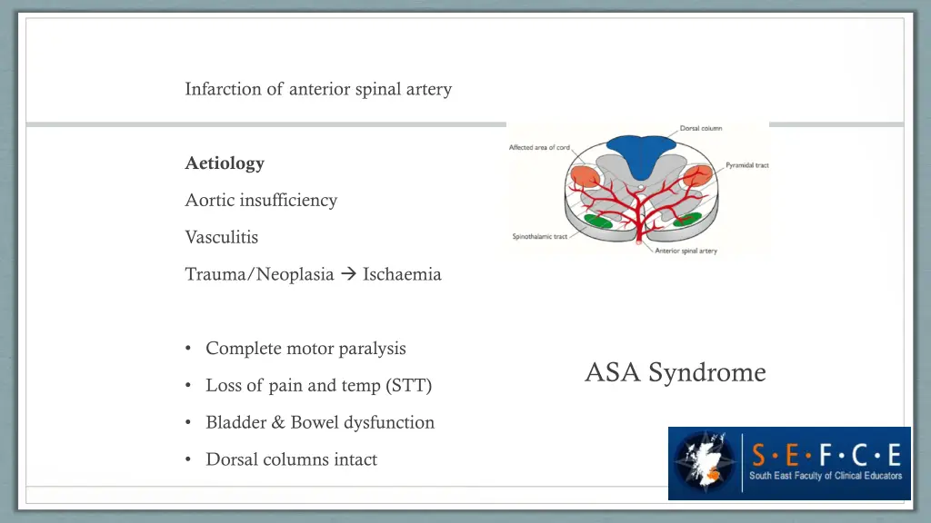 infarction of anterior spinal artery