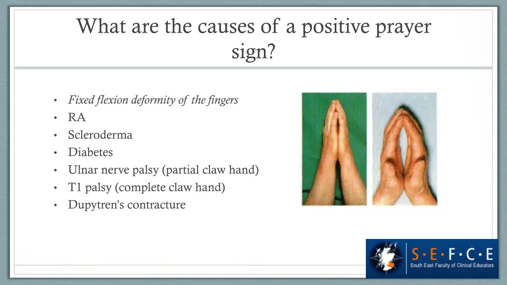 what are the causes of a positive prayer sign