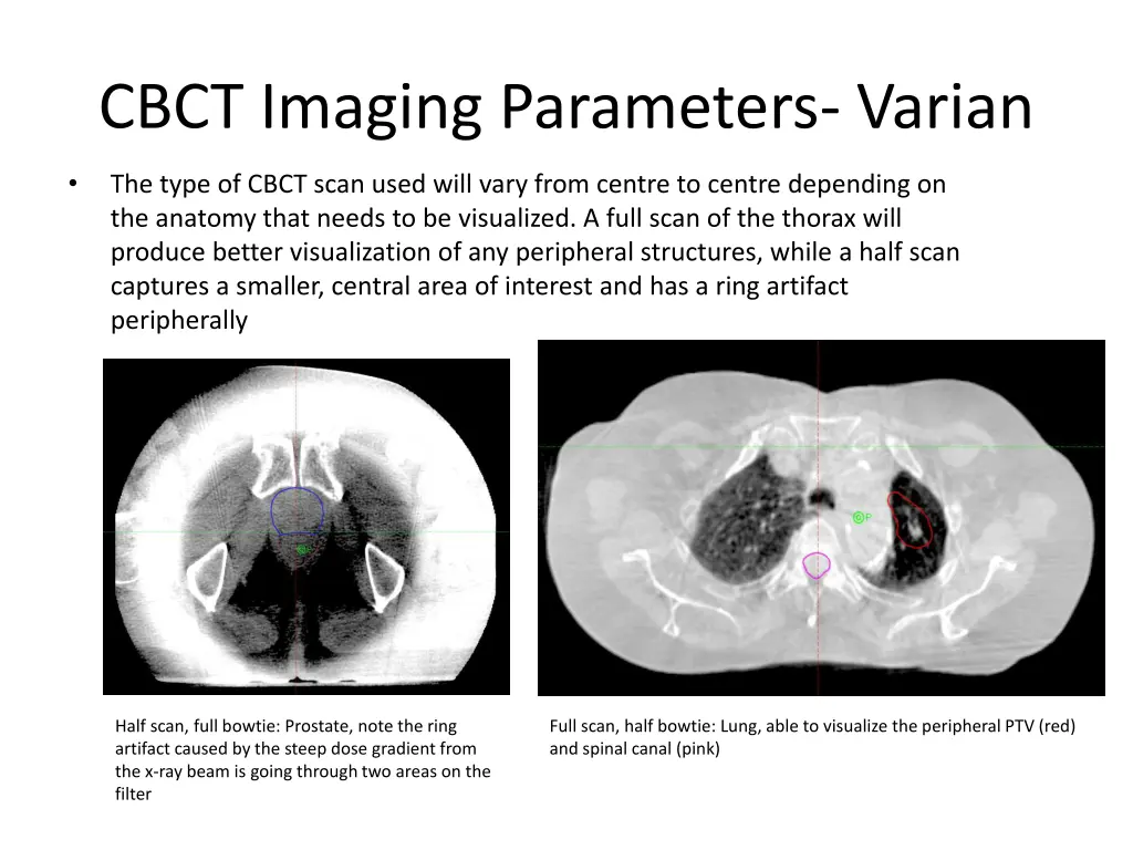 cbct imaging parameters varian 1