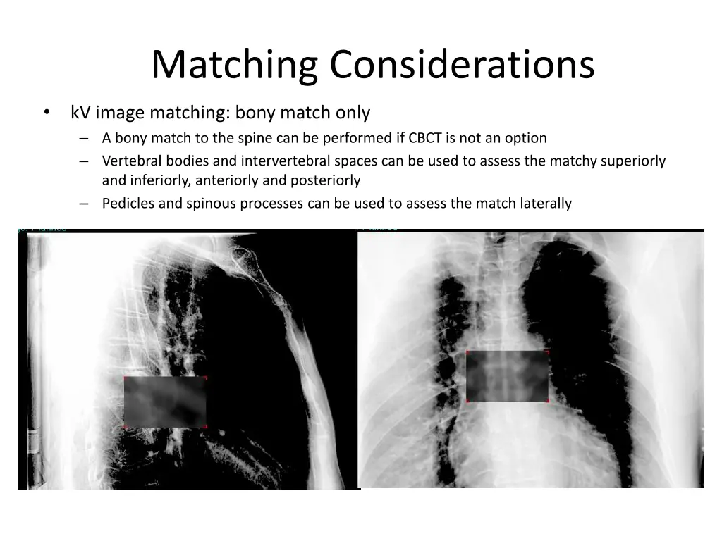 matching considerations 2