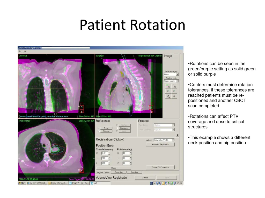 patient rotation