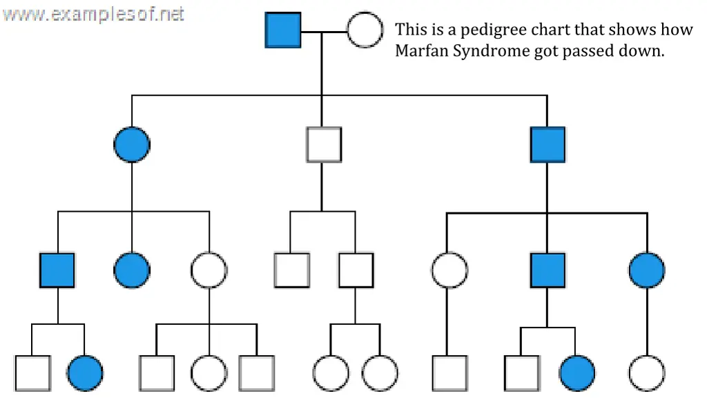 this is a pedigree chart that shows how marfan