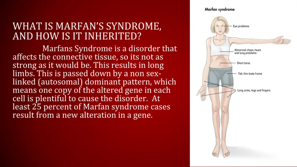 what is marfan s syndrome and how is it inherited