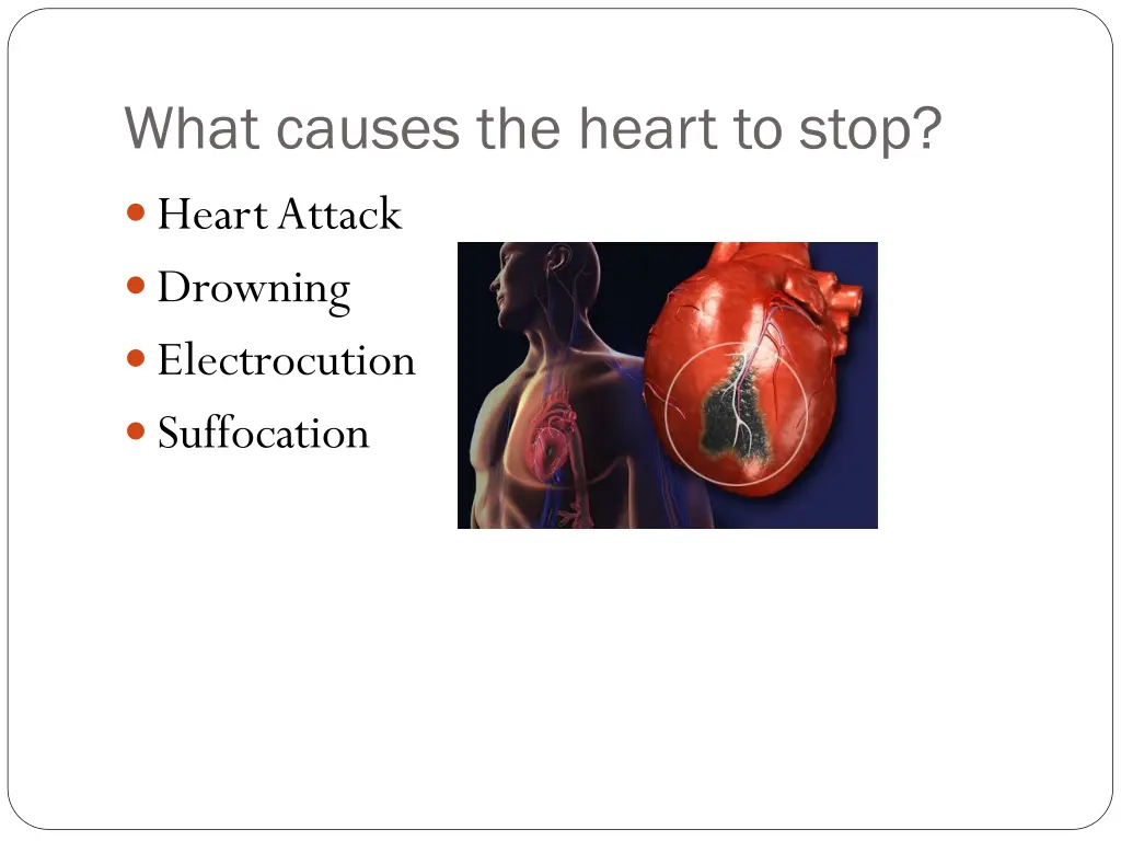 what causes the heart to stop