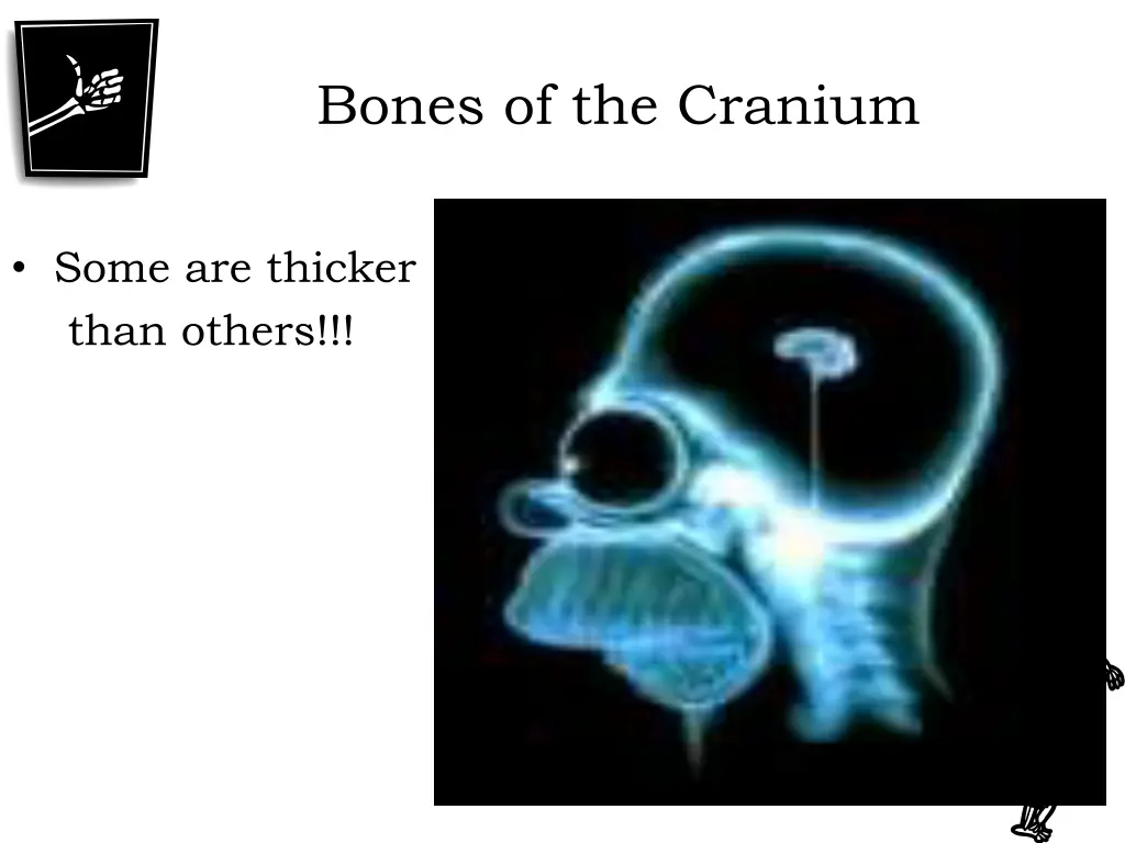 bones of the cranium