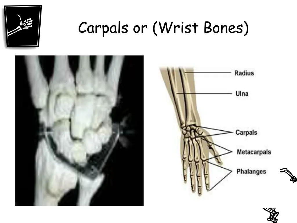 carpals or wrist bones