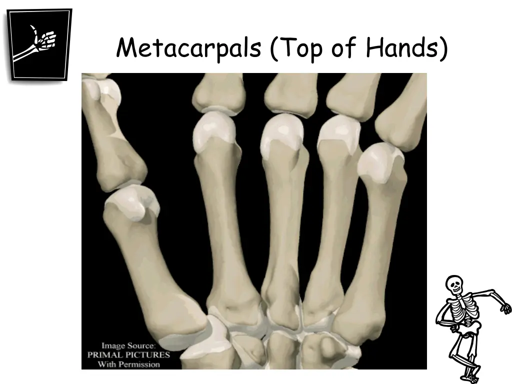 metacarpals top of hands