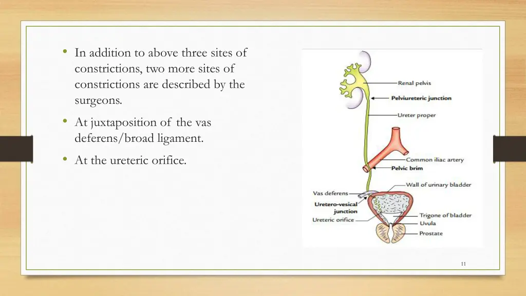 in addition to above three sites of constrictions