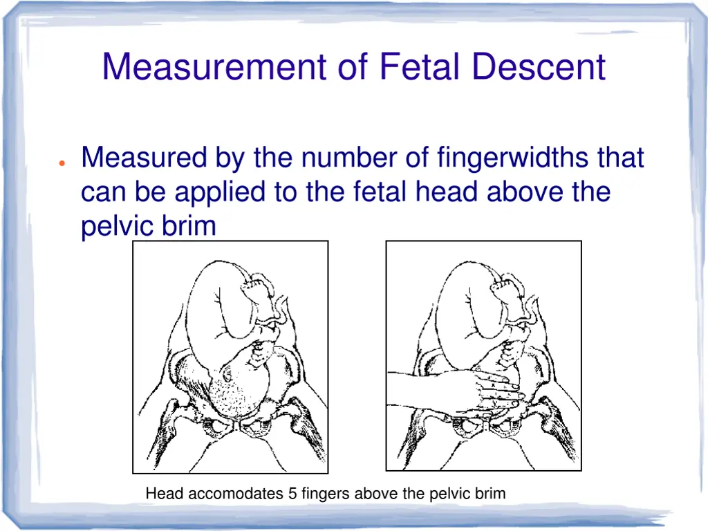 measurement of fetal descent