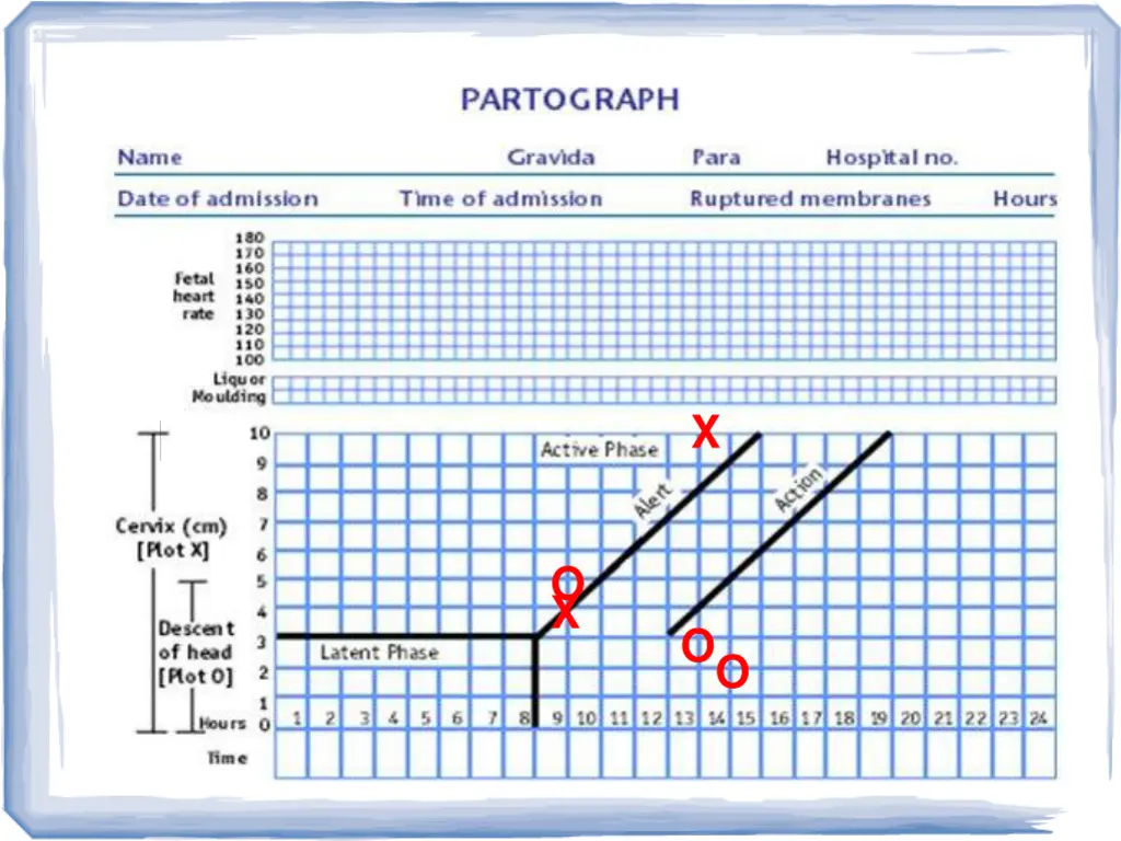 slide25