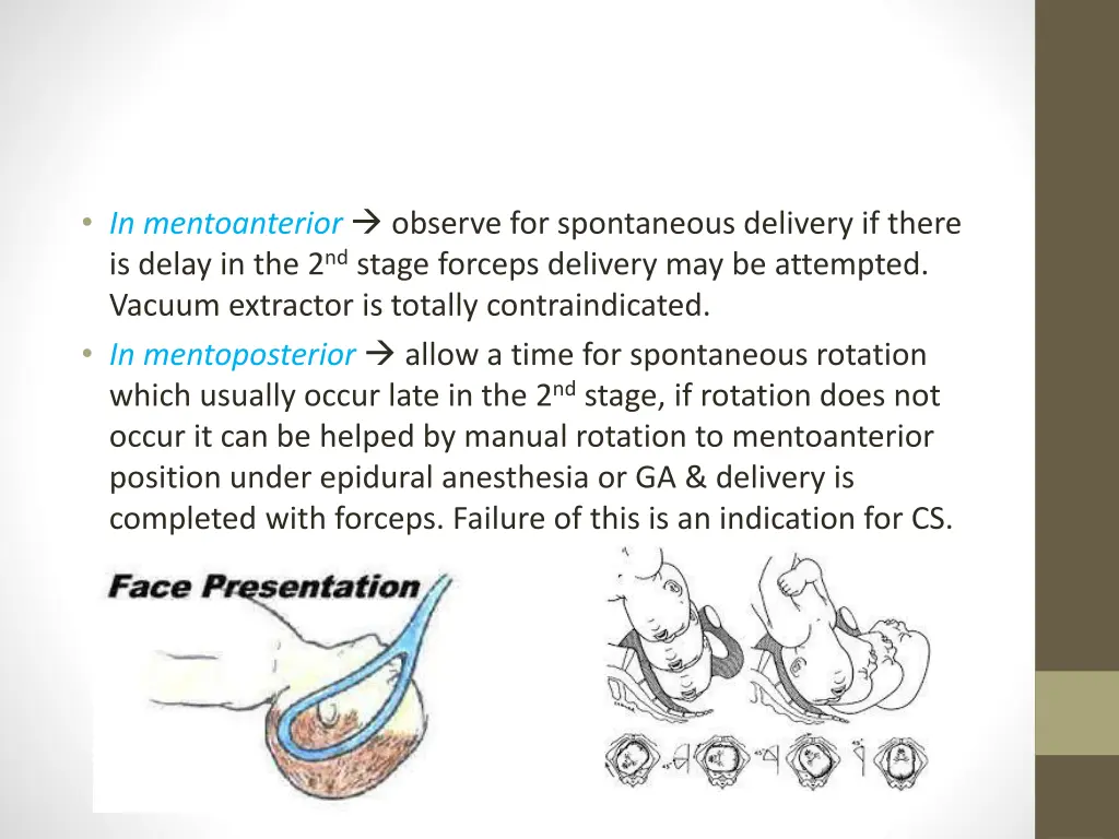 in mentoanterior observe for spontaneous delivery