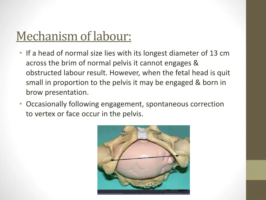 mechanism of labour 2